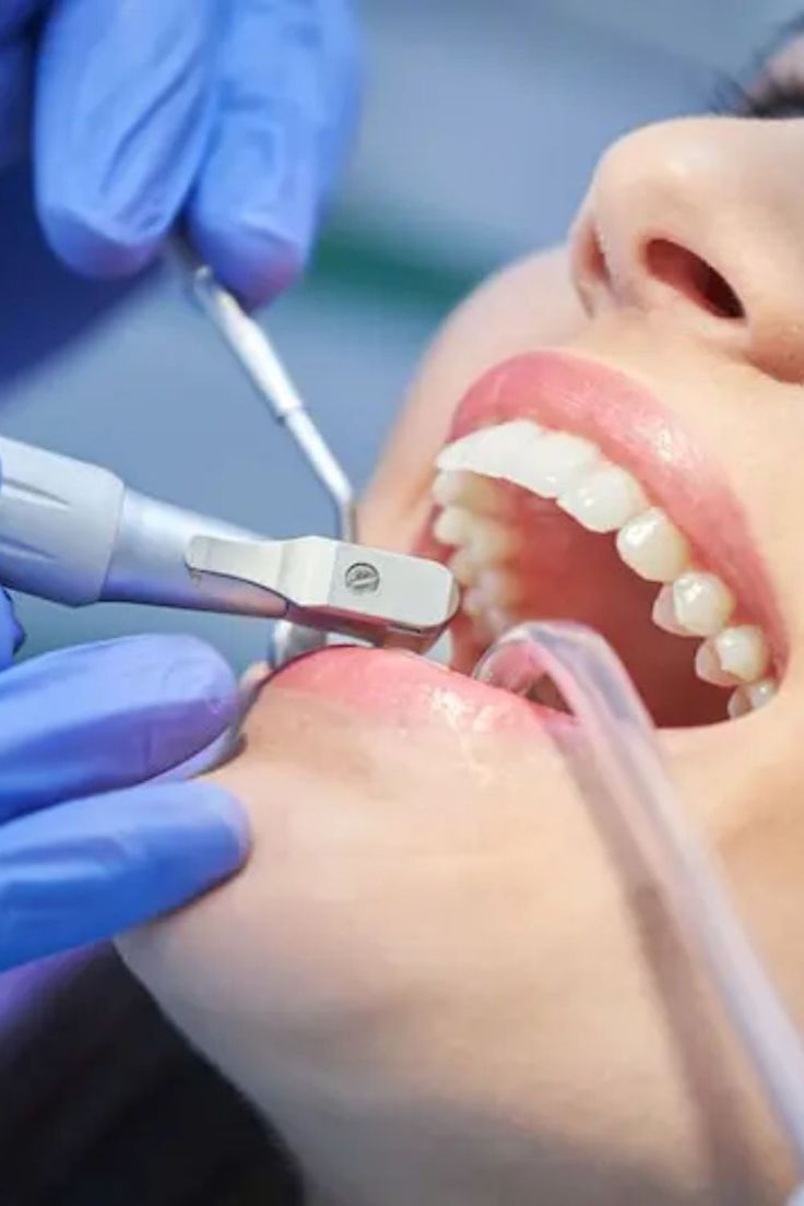 Limpieza Dental